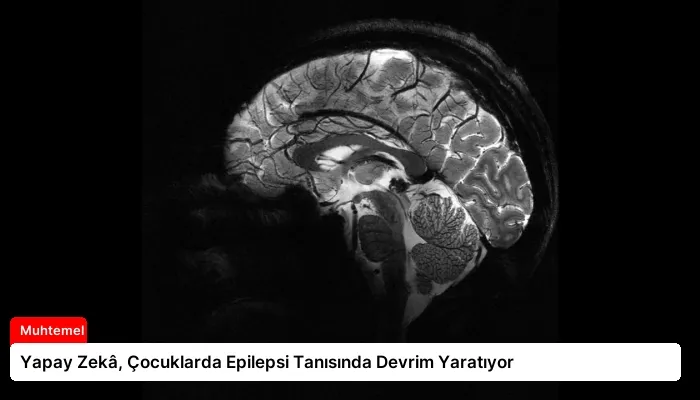 Yapay Zekâ, Çocuklarda Epilepsi Tanısında Devrim Yaratıyor