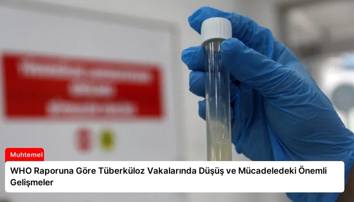 WHO Raporuna Göre Tüberküloz Vakalarında Düşüş ve Mücadeledeki Önemli Gelişmeler