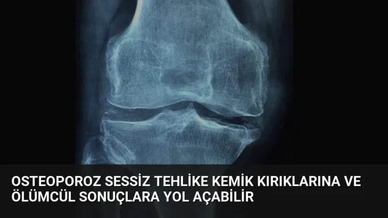 Osteoporoz Sessiz Tehlike Kemik Kırıklarına ve Ölümcül Sonuçlara Yol Açabilir