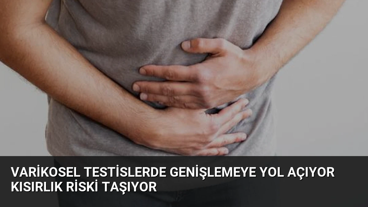 Varikosel Testislerde Genişlemeye Yol Açıyor Kısırlık Riski Taşıyor