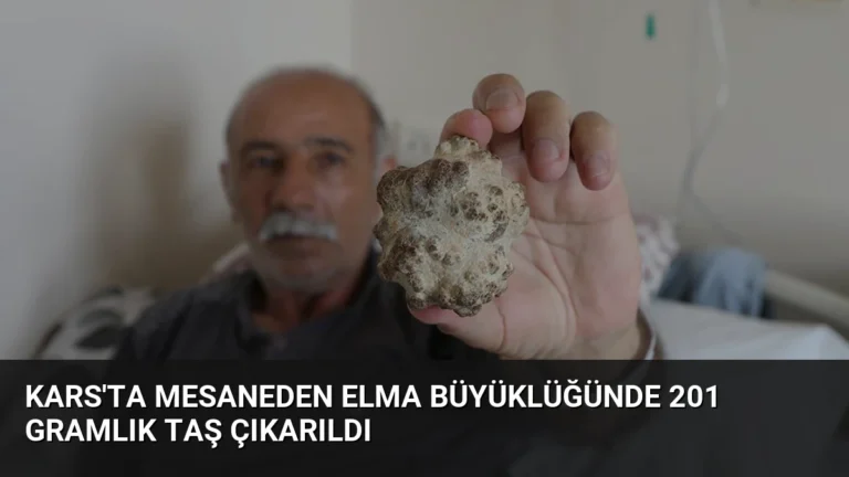 Kars’ta Mesaneden Elma Büyüklüğünde 201 Gramlık Taş Çıkarıldı