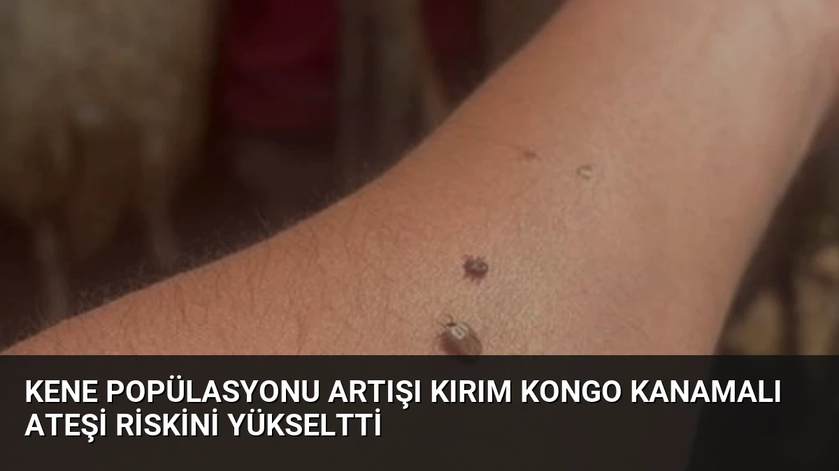 Kene Popülasyonu Artışı Kırım Kongo Kanamalı Ateşi Riskini Yükseltti