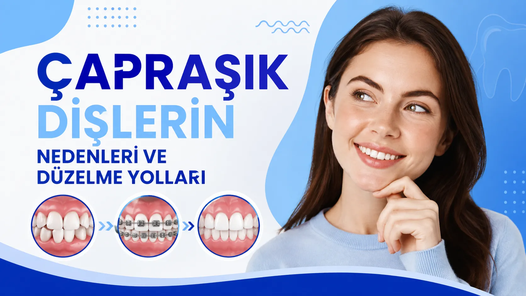 Çapraşık Dişlerin Nedenleri ve Düzelme Yolları